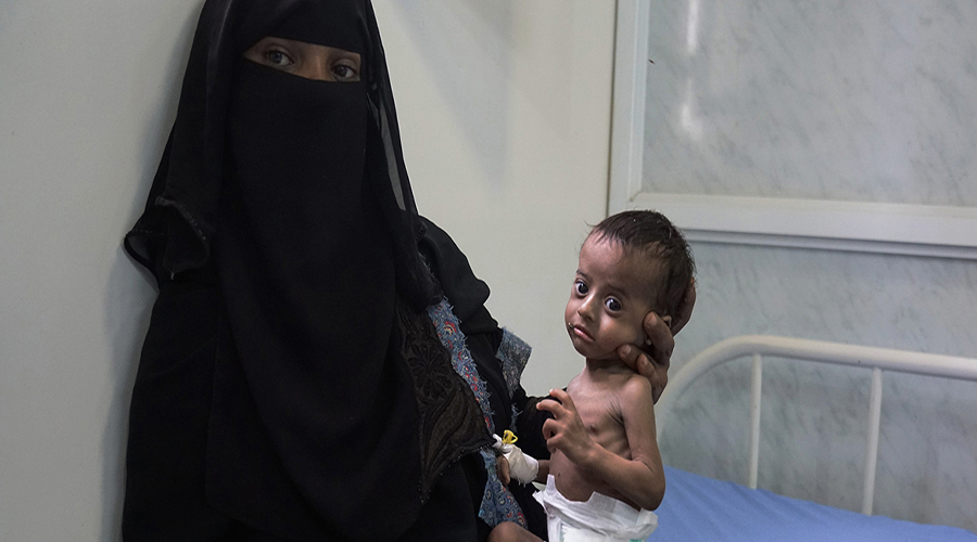 Yemen faces 'looming famine,'